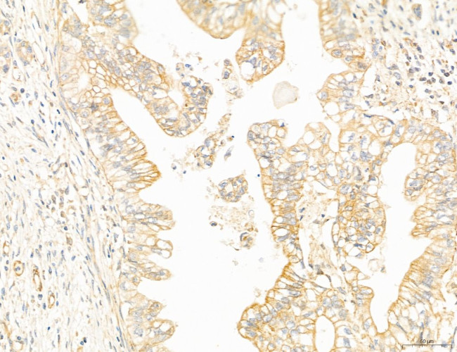 NOD2 Antibody in Immunohistochemistry (Paraffin) (IHC (P))