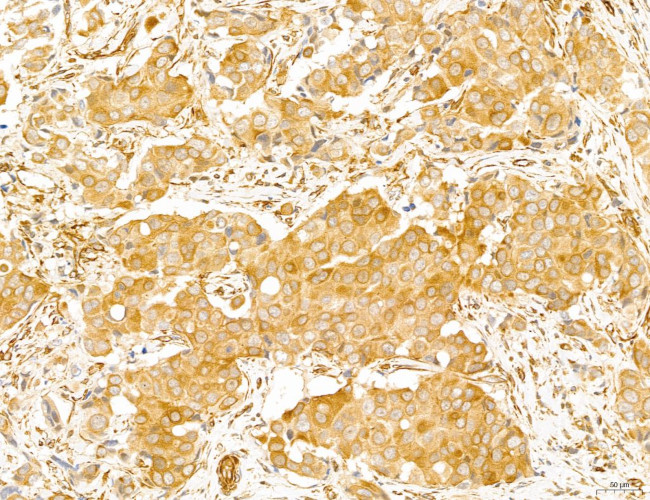 NOD2 Antibody in Immunohistochemistry (Paraffin) (IHC (P))