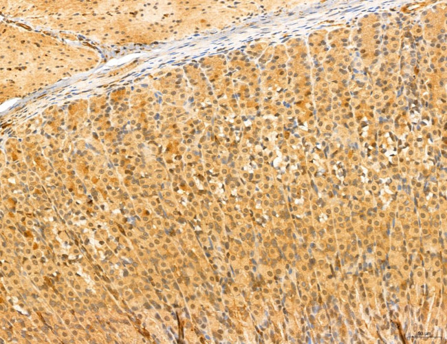 NOD2 Antibody in Immunohistochemistry (Paraffin) (IHC (P))