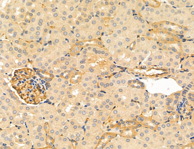 NOD2 Antibody in Immunohistochemistry (Paraffin) (IHC (P))