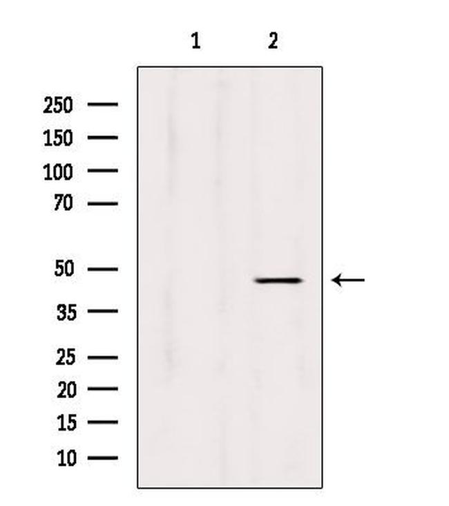 L2HGDH Antibody in Western Blot (WB)