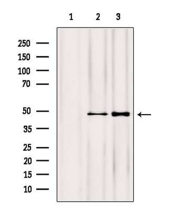 NOB1 Antibody in Western Blot (WB)