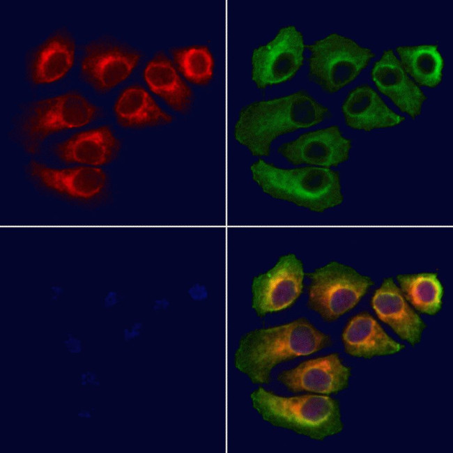 TIMM22 Antibody in Immunocytochemistry (ICC/IF)