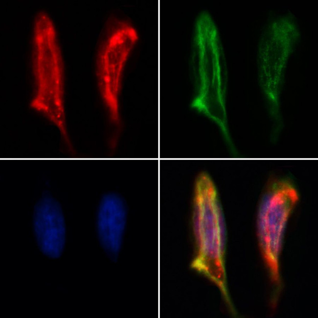 BCO2 Antibody in Immunocytochemistry (ICC/IF)