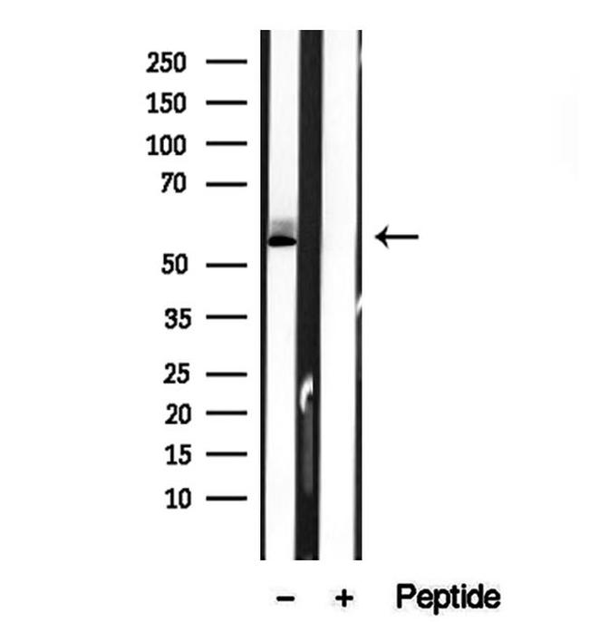 BCO2 Antibody in Western Blot (WB)