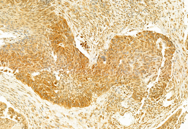 GSDMD Antibody in Immunohistochemistry (Paraffin) (IHC (P))