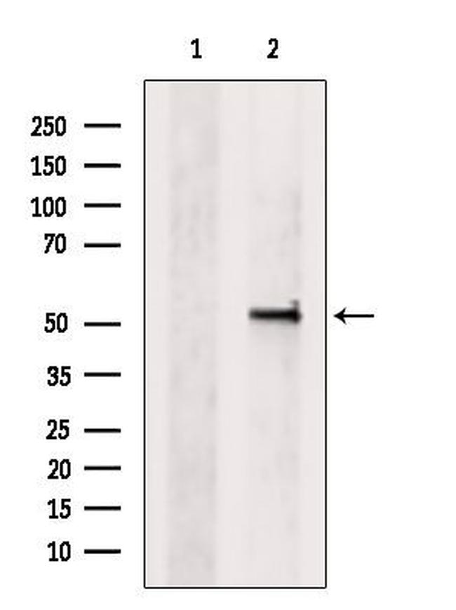 GSDMD Antibody in Western Blot (WB)