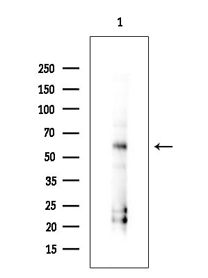 GSDMD Antibody in Western Blot (WB)