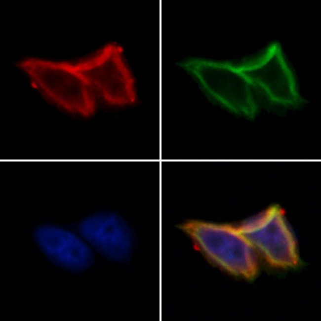 SLC30A3 Antibody in Immunocytochemistry (ICC/IF)