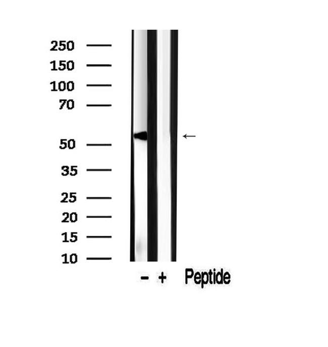 SLC30A3 Antibody in Western Blot (WB)