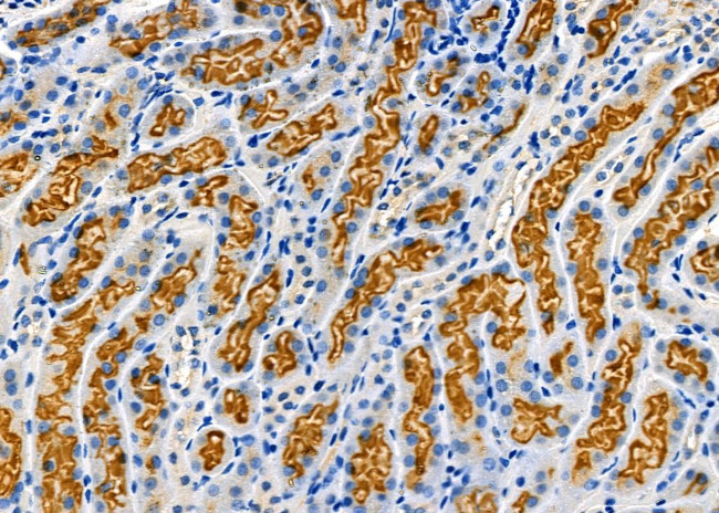 BBS4 Antibody in Immunohistochemistry (Paraffin) (IHC (P))