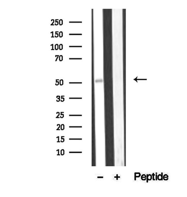 BBS4 Antibody in Western Blot (WB)