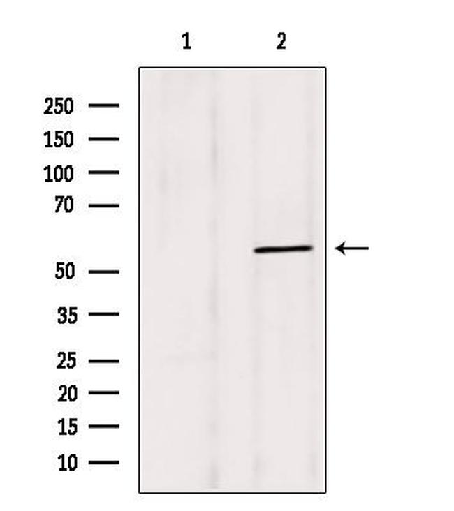 BBS4 Antibody in Western Blot (WB)