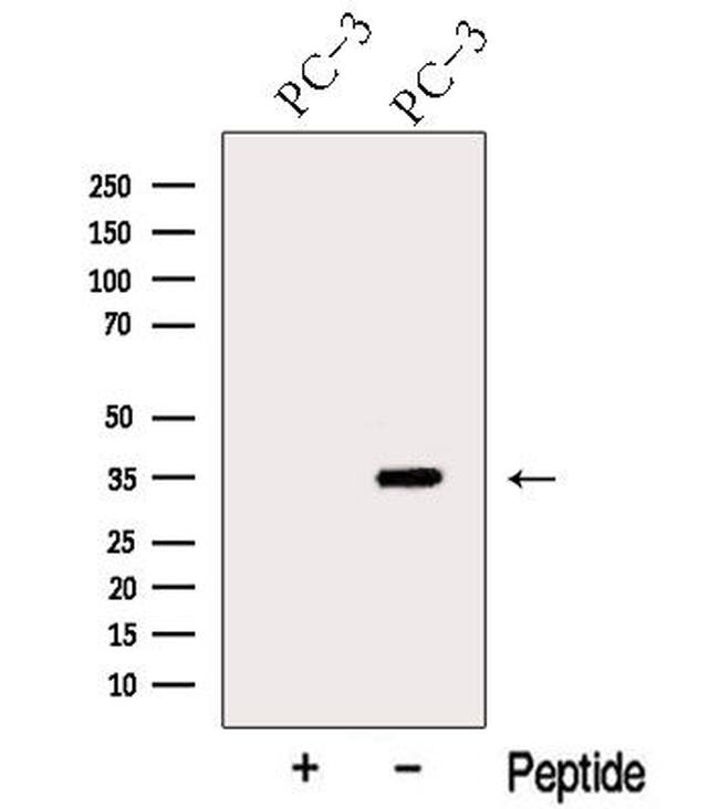 ARPC2 Antibody in Western Blot (WB)