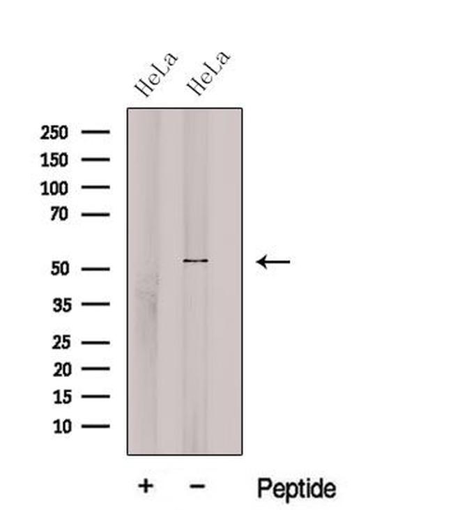 cGAS Antibody in Western Blot (WB)