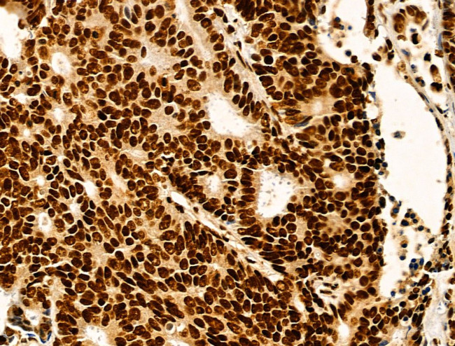 HTATSF1 Antibody in Immunohistochemistry (Paraffin) (IHC (P))