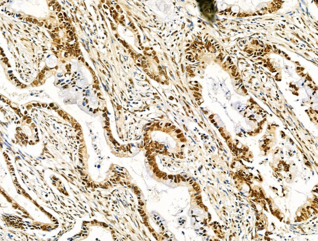 HTATSF1 Antibody in Immunohistochemistry (Paraffin) (IHC (P))