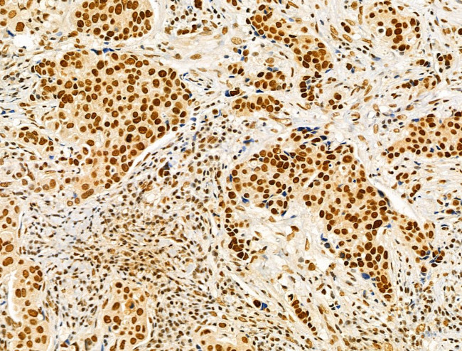 HTATSF1 Antibody in Immunohistochemistry (Paraffin) (IHC (P))