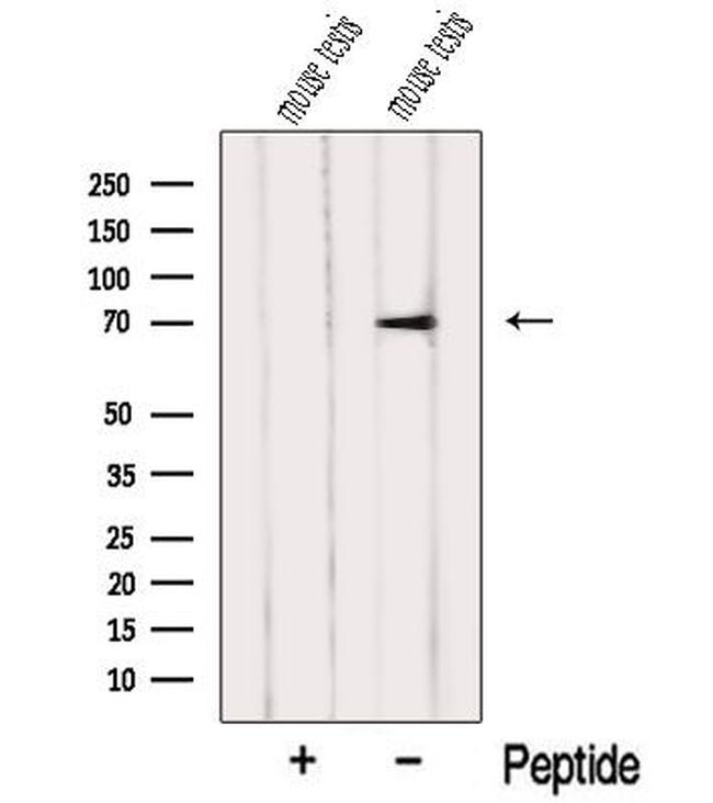 NXF2 Antibody in Western Blot (WB)