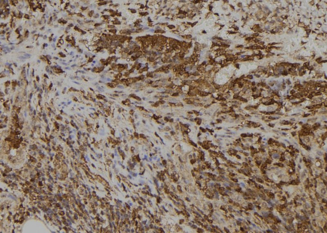 SLC5A5 Antibody in Immunohistochemistry (Paraffin) (IHC (P))