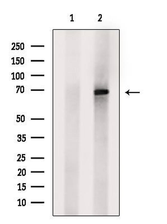 SLC5A5 Antibody in Western Blot (WB)