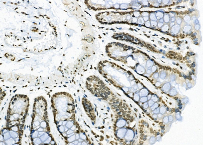 APITD1 Antibody in Immunohistochemistry (Paraffin) (IHC (P))