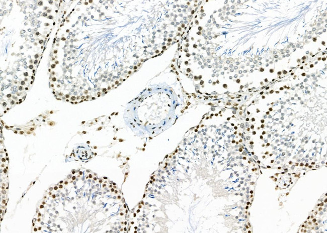 APITD1 Antibody in Immunohistochemistry (Paraffin) (IHC (P))