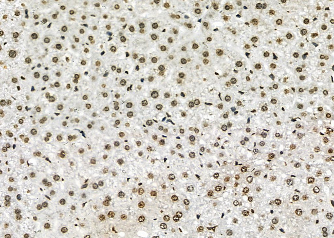 APITD1 Antibody in Immunohistochemistry (Paraffin) (IHC (P))