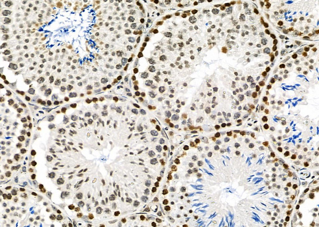 APITD1 Antibody in Immunohistochemistry (Paraffin) (IHC (P))