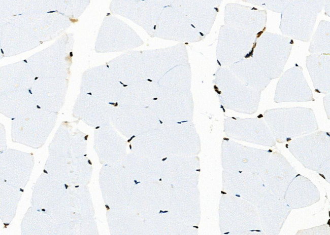 APITD1 Antibody in Immunohistochemistry (Paraffin) (IHC (P))