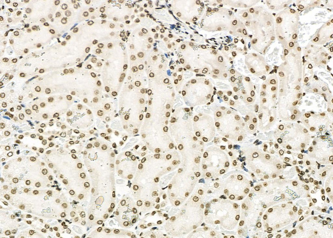 APITD1 Antibody in Immunohistochemistry (Paraffin) (IHC (P))