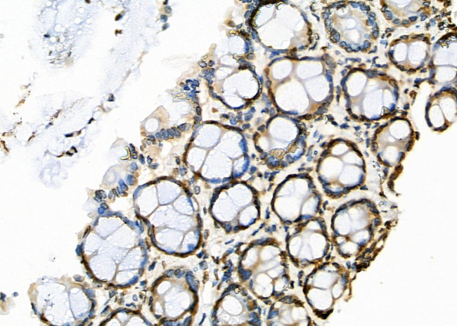 APITD1 Antibody in Immunohistochemistry (Paraffin) (IHC (P))