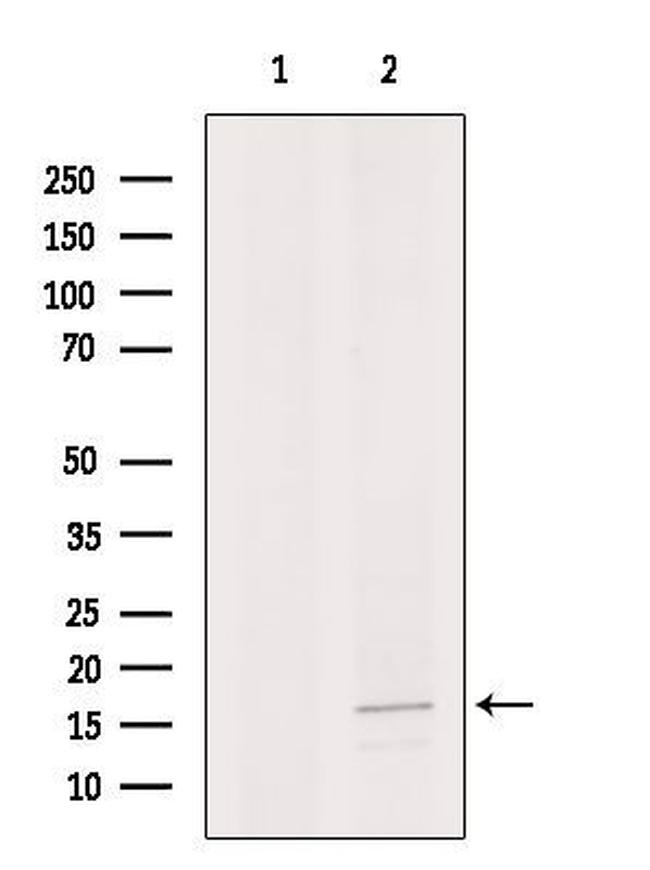 APITD1 Antibody in Western Blot (WB)