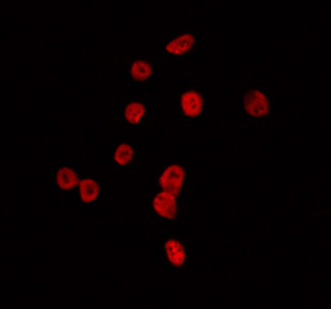 TAF1B Antibody in Immunocytochemistry (ICC/IF)