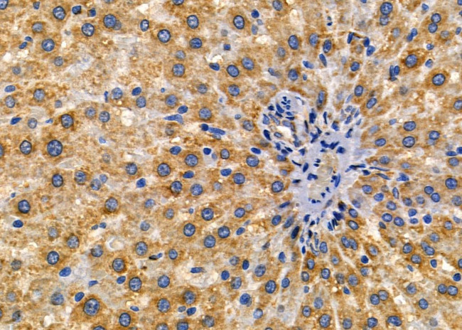 IL12RB1 Antibody in Immunohistochemistry (Paraffin) (IHC (P))