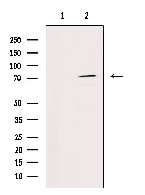 IL12RB1 Antibody in Western Blot (WB)