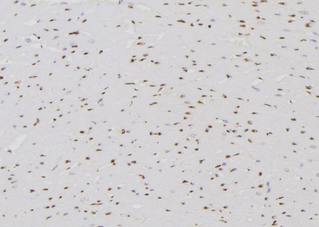 ETK Antibody in Immunohistochemistry (Paraffin) (IHC (P))