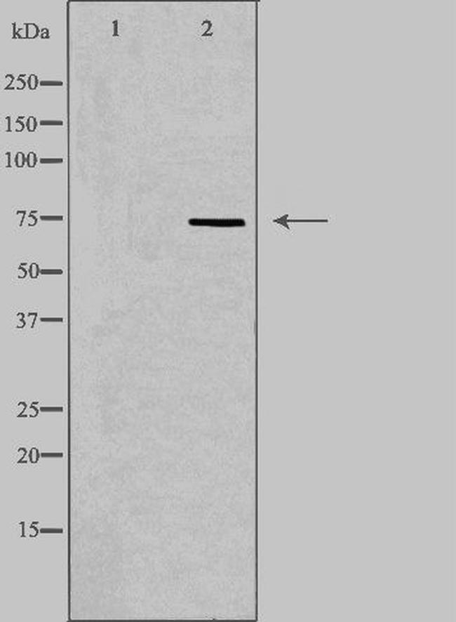 ETK Antibody in Western Blot (WB)