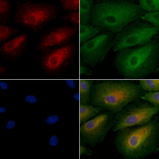 JAKMIP2 Antibody in Immunocytochemistry (ICC/IF)