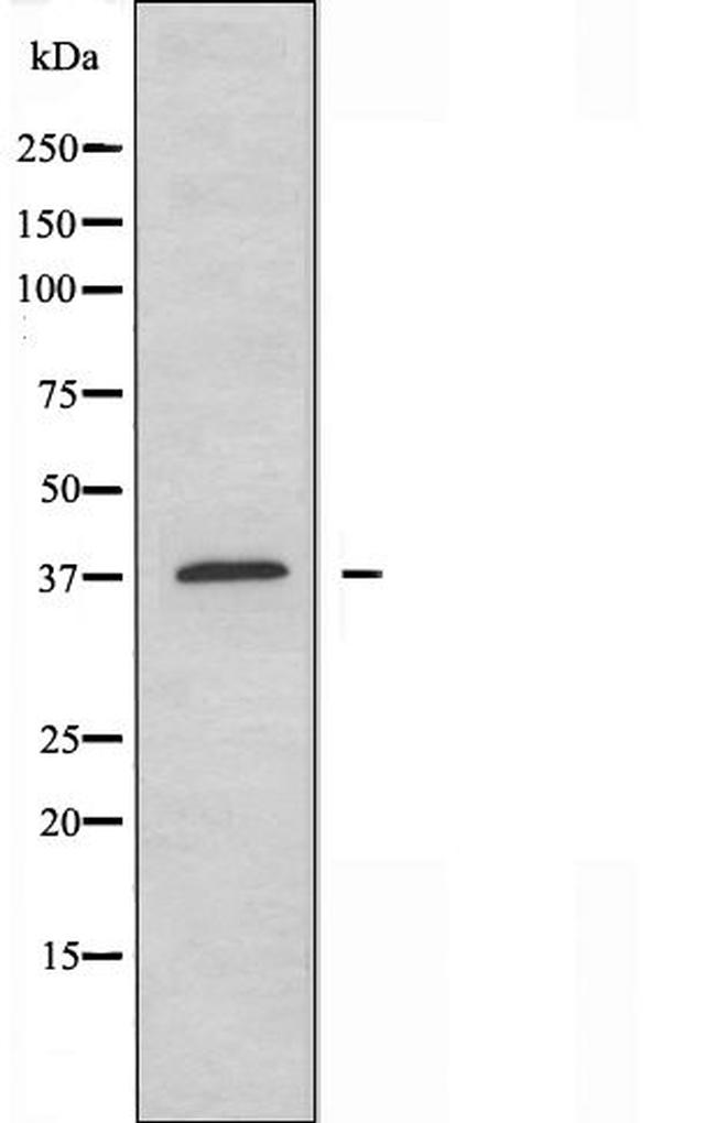 AMPK gamma-1 Antibody in Western Blot (WB)