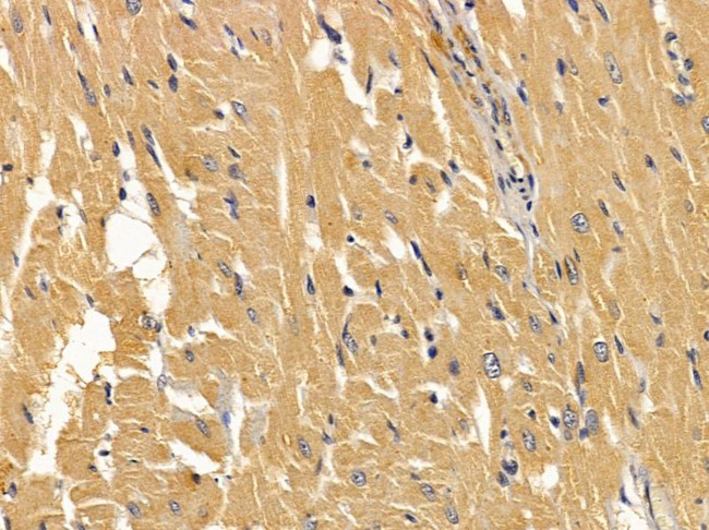 ABCD1 Antibody in Immunohistochemistry (Paraffin) (IHC (P))