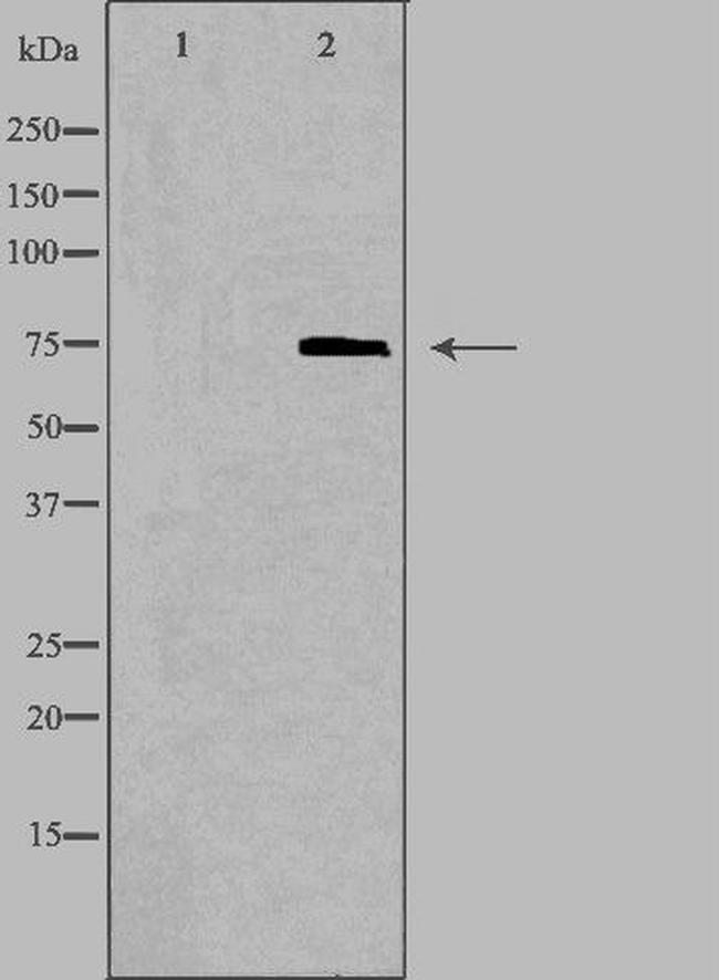 ABCD1 Antibody in Western Blot (WB)