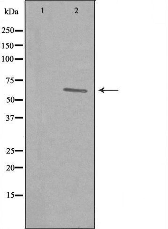 REC8 Antibody in Western Blot (WB)