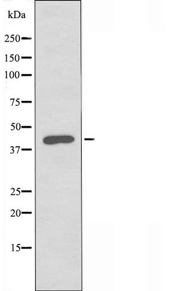 SIRP gamma Antibody in Western Blot (WB)