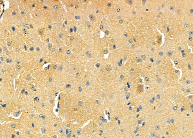 D4 Dopamine Receptor Antibody in Immunohistochemistry (Paraffin) (IHC (P))