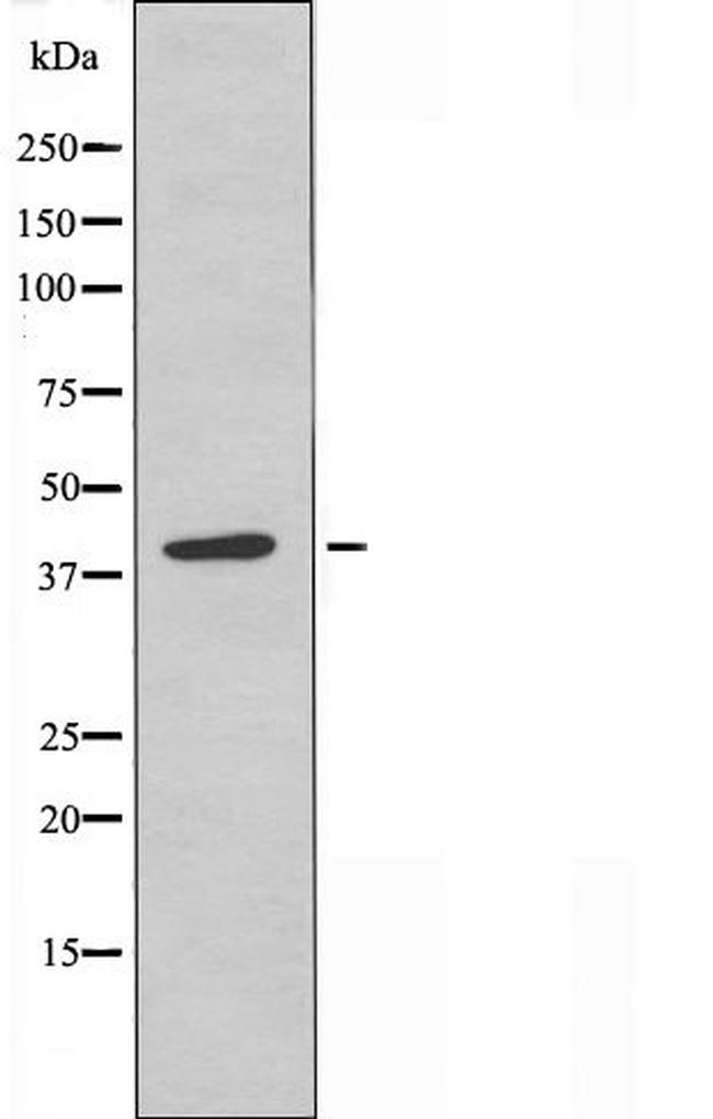 GPR174 Antibody in Western Blot (WB)