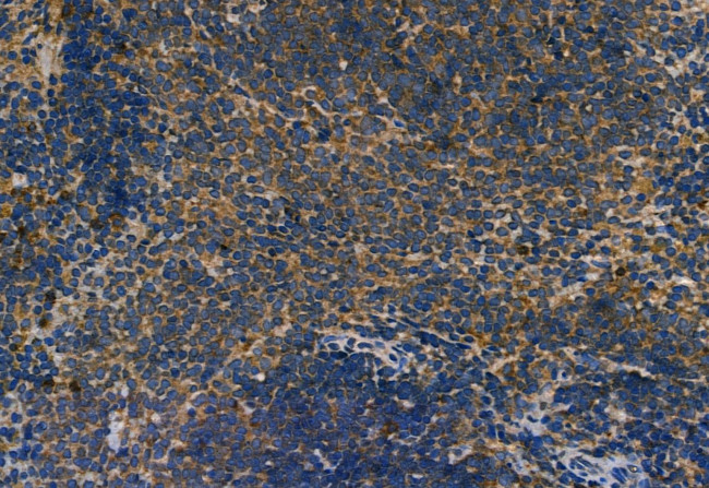 SMO Antibody in Immunohistochemistry (Paraffin) (IHC (P))