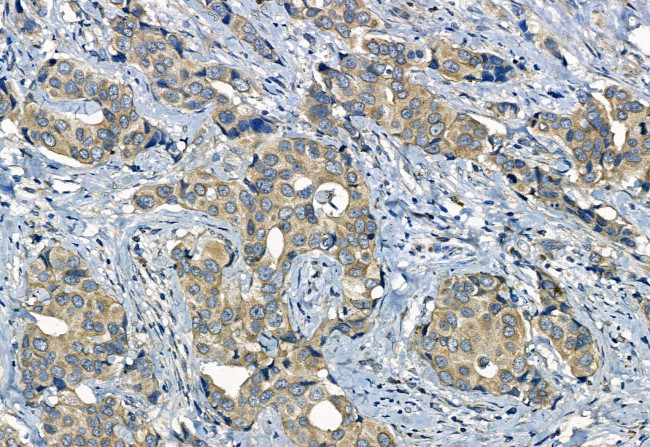 SMO Antibody in Immunohistochemistry (Paraffin) (IHC (P))