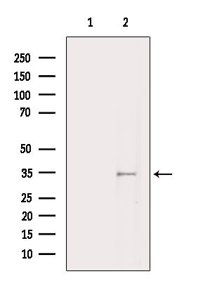 OR2W3 Antibody in Western Blot (WB)