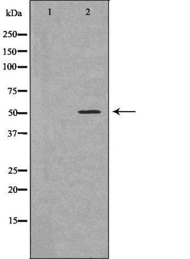 Bcl-rambo Antibody in Western Blot (WB)